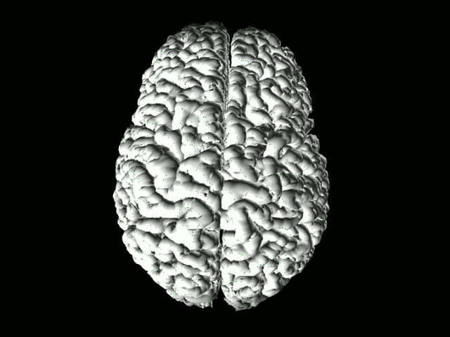 Brain, top